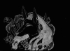 Anubis